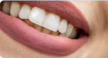 Close-up of a bright, natural-looking smile after cosmetic dental treatment