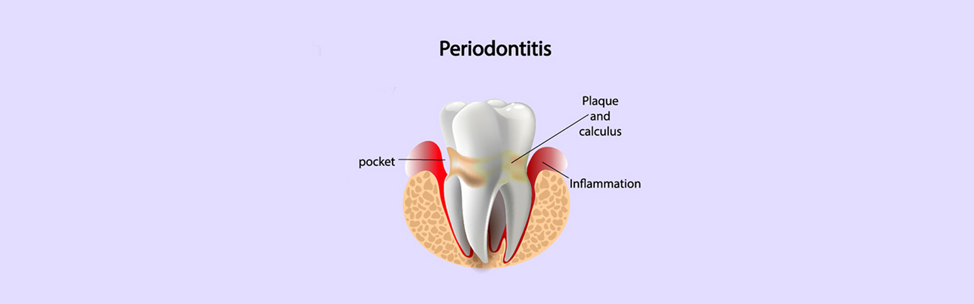 All You Need to Know About Periodontics in Welland