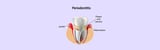All You Need to Know About Periodontics in Welland